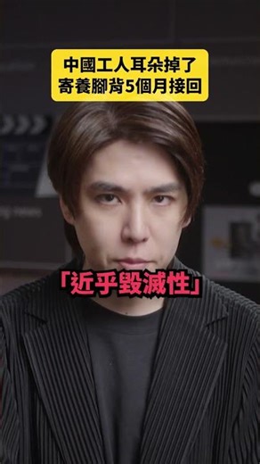 中國工人耳朵掉了，寄養腳背5個月接回｜志祺七七 Shorts #daily