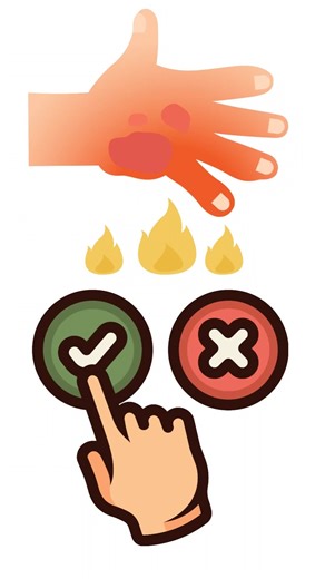 🔥 Diwali Burn First Aid in 13 Seconds | Myths vs Reality 🚑