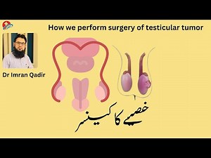 How we perform surgery of testicular tumor خصیے کا کینسر Dr Imran Qadir