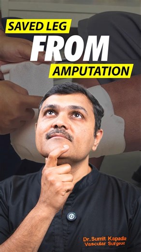 Saved From Amputation! 😱 Gangrene Reversed