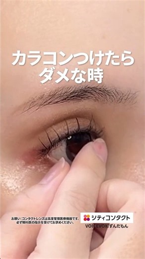 【初めてのコンタクトレンズ】カラコン付けたらダメなとき