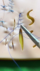 Running locking suture (part 2) | Dermhacks