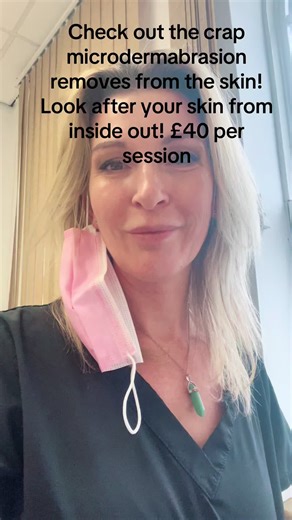 Microdermabrasion Results Revealed: Before and After