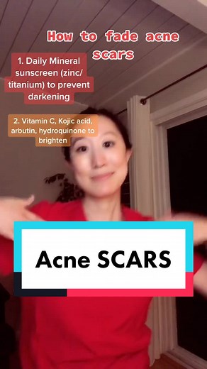 How to Fade Acne Scars: Skincare Tips