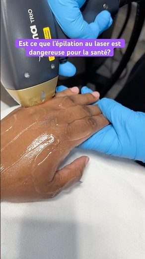 Est ce que l’épilation au laser peut causer un cancer?