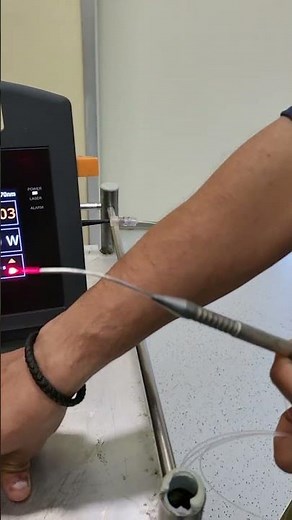 How things work- Laser for treatment of Piles, fissure, complex fistula and Pilonidal sinus.