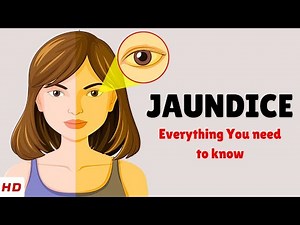 What is Jaundice? Causes, Signs and Symptoms, Diagnosis & Treatment