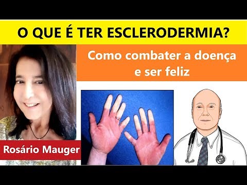 O que é ter esclerodermia / esclerose sistêmica? O diagnóstico e o tratamento.