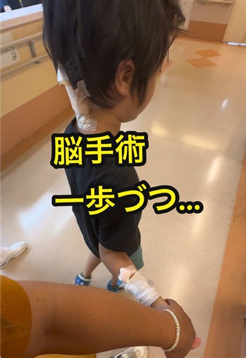 5/18に脳の手術をして 5/24の今日 フラつきも少なくなってきました🌺 順調に回復してます💕 たくさんのコメント ありがとうございます✨ お返事する時間を璃空との時間に変えさせてもらってますが しっかり読ませて頂いてます💖 みなさんのコメントが 確実に私たちの力になってます❤️ありがとうございます❤️✨ 感謝です。 同じキアリ奇形のお母さんたちのお力にもなりたいなと思い、経過を記録、投稿させてもらってます。 2025.8ころからイビキが気になり始めて耳鼻科受診 扁桃腺肥大、アデノイド摘出の手術を受けるが 一向に良くならず。 風邪こじらせクループ症候群で入院。 退院するもいびきはさらに酷くなる一方で、またクループ発症で入院。 手術した病院に転院したところ、小児科医に診てもらえることに。 私の勘で絶対に違う原因があるはず！！！MRIを撮ってもらえないかとお願いした。 そしてキアリ発覚。。 2026.3 あの時、先生の診断を無視する言い方をしてごめんなさいと思ったけど、この子を見て来てるのは私。言ってみて良かった。 詳しい検査をした方がいいとの事で、こども医療センターに紹介状を書い