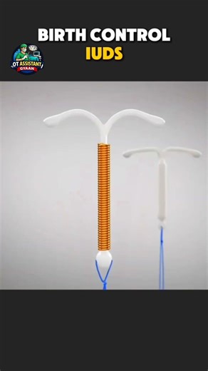 BIRTH CONTROL IUDS ✅ #trending #shorts #medicalhindi #otassistant #medicalknowledge #viral #hospital