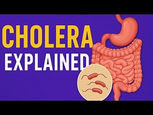 Understanding Cholera: Key Concepts in Pathology | MedQuick Series