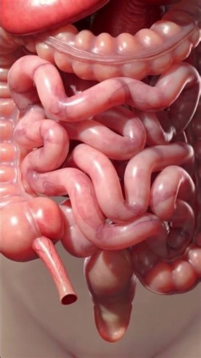 Where Is Your Appendix — And Why It Gets Inflamed