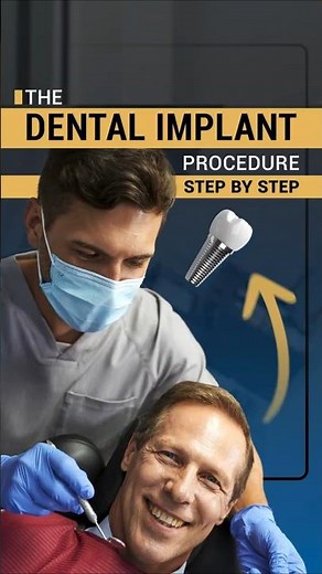 🚨 Dental Implant Procedure Step by Step | Restore Your Smile Safely 🚨