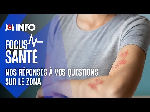 Le zona, une infection causée par le virus de la varicelle