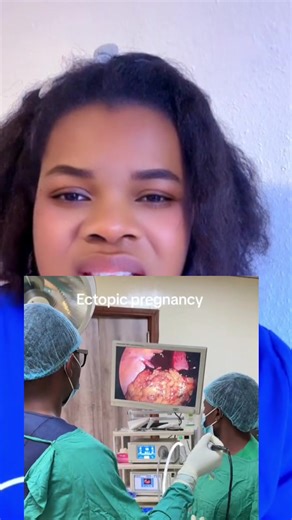 Understanding Ectopic Pregnancy: Causes and Risks