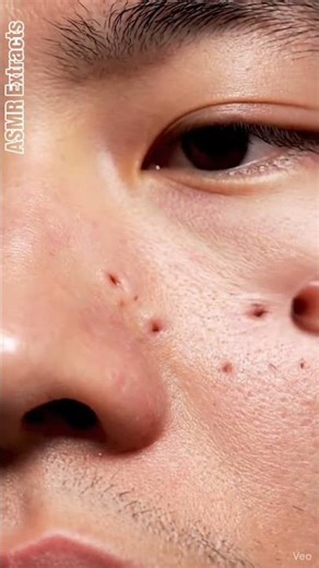 ASMR Extracts | Pore Cleaning