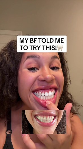 Snow Teeth Whitening Powder Review