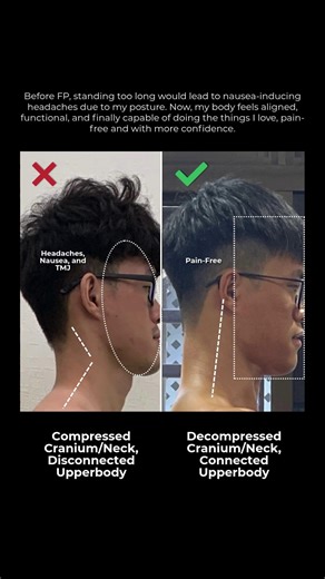 Functional Patterns Evidence Based Practice on Instagram: "At FP, we have the goods. We dial in the body—the system—first, and the cranium and mandible follow. When you can sprint like a beast (a human one), you start to look like one too. Elite work here by FP HBS @damien.tang_ 👇 “Before FP, my posture would cause me neck pain which lead headaches until nausea. I couldn’t stand for too long due to the hyperextended knees and soreness lower back muscles. I was the skinny, get tired easil
