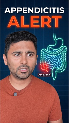 Classic Signs of Appendicitis