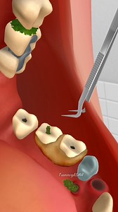 1.5M views · 4.3K reactions | One Tooth Rubber_ Dirt Deep Remove #teethcare #dirt #shorts #asmr #animation #toothcare #cleaning #satisfying #mouthcare #fbreelsfypシ゚viralシ #reelstrending #facebookreel #shortsreels #trendingreels #cavity #tooth #asmrcleaning #asmrvideo #relaxing #satisfy #fb #trendingnow Tunnig ASMR | Tunnig ASMR | Facebook