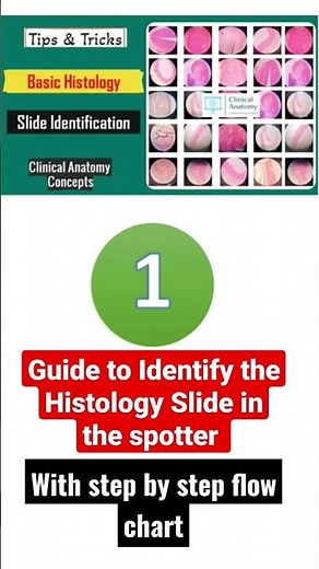 Histology Spotter Identification Tips & Tricks - Complete Flow Chart