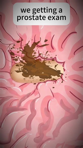 We getting a prostate exam😂😂😂#funny #animation #usa #foryou #fyp | Animation