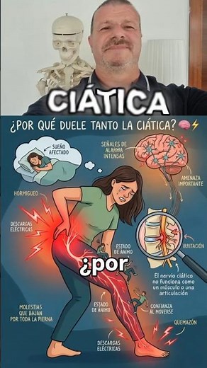 ¿POR QUÉ DUELE TANTO LA CIÁTICA? 🧠⚡