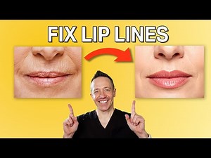 Amazing NEW Treatments for Lip Lines — Doctor Explains
