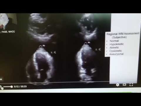 Media1 Test 2 Q.1 DMS 232