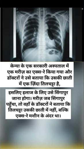 The doctor said there was a cockroach in the chest... everyone was shocked to learn the truth 😲🪳