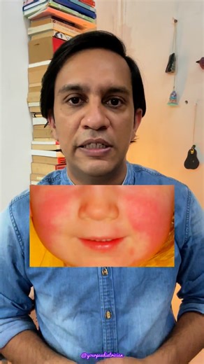 2.3K views · 13 comments | Child Health Alert  Slapped Cheek...