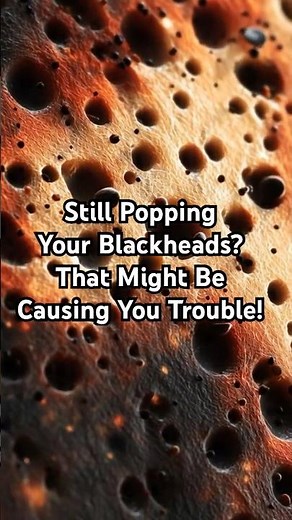 Blackheads Keep Coming Back | Why Nothing Works & How to Remove Them Safely #healthshorts