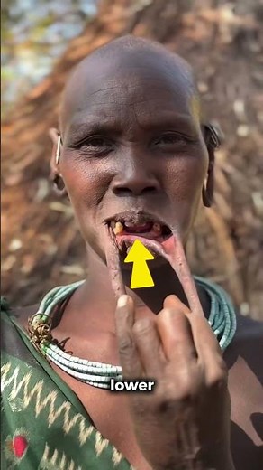 How far would you go for beauty? 😲