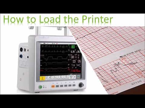 How to Install Edan Patient Monitor Printer