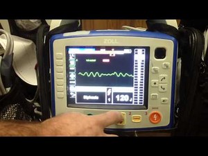 Defibrillation on Zoll X series