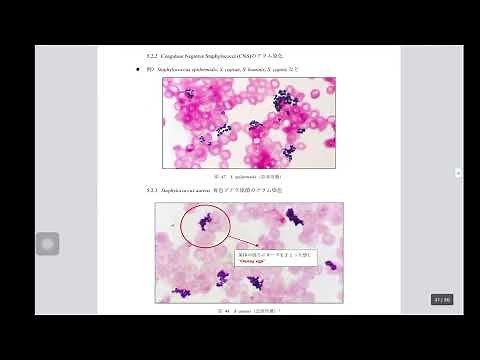 黄色ブドウ球菌とCNSをグラム染色で見分ける方法！
