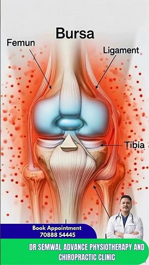 Bursa and Bursitis: Why Your Joints Hurt | Dr semwal | dehradun |