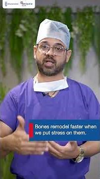 Bone Health Myths vs Facts - What You Should Really Know