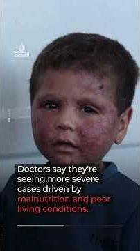 Gaza’s displaced families face worsening living conditions