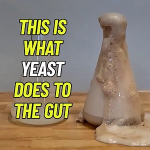 118 reactions · 68 shares | Unwanted weight, digestive issues, low energy... all can be caused by YEAST OVERGROWTH. According to nutrition & gut health expert, Dr. Amy Lee, these are the foods to look out for. Find out exactly which foods are causing so many recent American health issues—and what's helping thousands powerfully improve their digestion, metabolism & daily energy. Get Bio-X4 now lnk.to/BX4CT | Nucific | Facebook