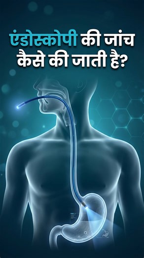 एंडोस्कोपी की जांच कैसे की जाती है ? How to do Endoscopy Procedure of Endoscopy #endoscopy #cancer