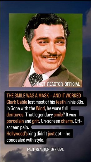 CLARK GABLE WORE FALSE TEETH IN GONE WITH THE WIND#OldHollywood #BehindTheSmile #youtubeshorts