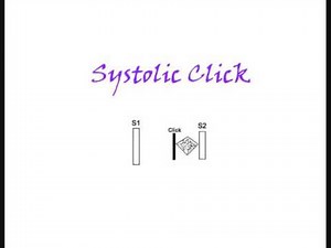 Mitral valve prolapse mid systolic click YouTube