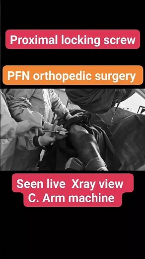 proximal femoral Nailing Procedure #ot #orthoconcepts #medicalinstruments #education #orthopedics