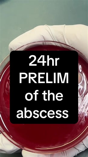 Guys, nothing grew yet! I’ll post at 48hrs and check anaerobic growth! #scientist #labtech #diagnosis #micobiology #hospital