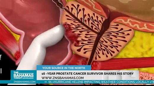 16 YEAR PROSTATE CANCER SURVIVOR SHARES HIS STORY Sixteen years after being diagnosed with prostate cancer, he is not only a survivor, but he is thriving, and wants men to know it does not have to be a death sentence. Cleopatra Murphy has his story. | ZNS Northern Service