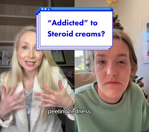 Understanding Topical Steroid Withdrawal: Causes, Effects, and Recovery