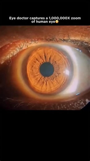 Medical | Science | Facts on Instagram: "What you’re seeing in this close-up is the intricate structure of the iris, made up of layered connective tissue, blood vessels, and muscle fibers. The visible patterns come from the anterior border layer and the stroma beneath it. The fine radial lines extending toward the pupil reflect the arrangement of iris muscles and vessels, often described as radial folds or Archer’s ligaments. The darker oval or triangular gaps between these fibers are Crypts of 