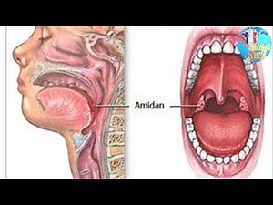 Traitements cancer de la gorge