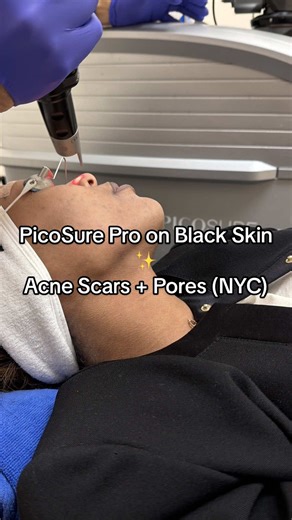 Transforming Skin with PicoSure Pro at Tribeca Aesthetics